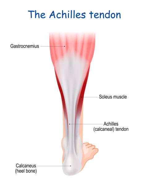 achilles-tendon